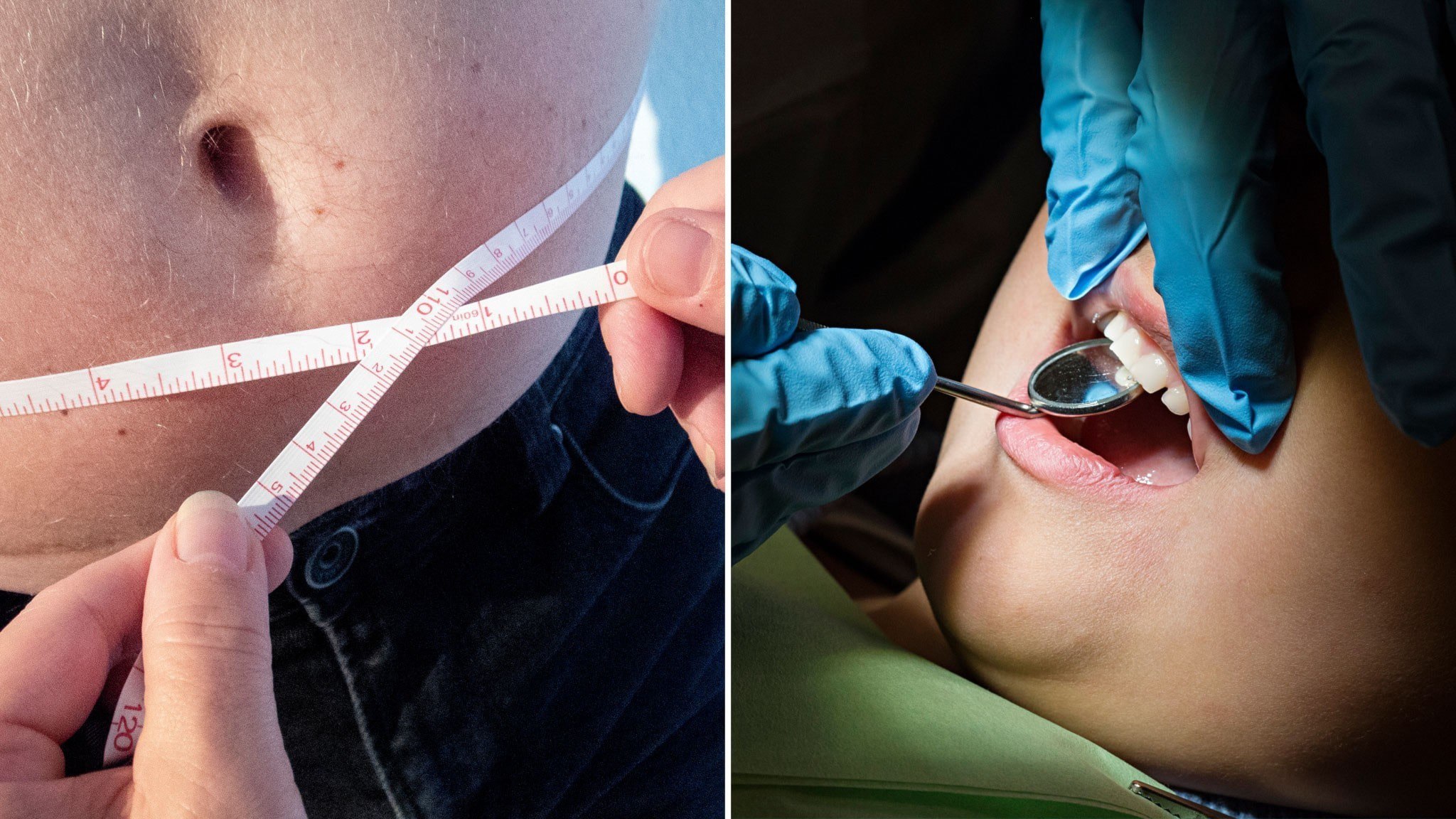 ⚡️ چاقی، پوسیدگی دندان و آسم در میان کودکان خردسال در حال افزایش است