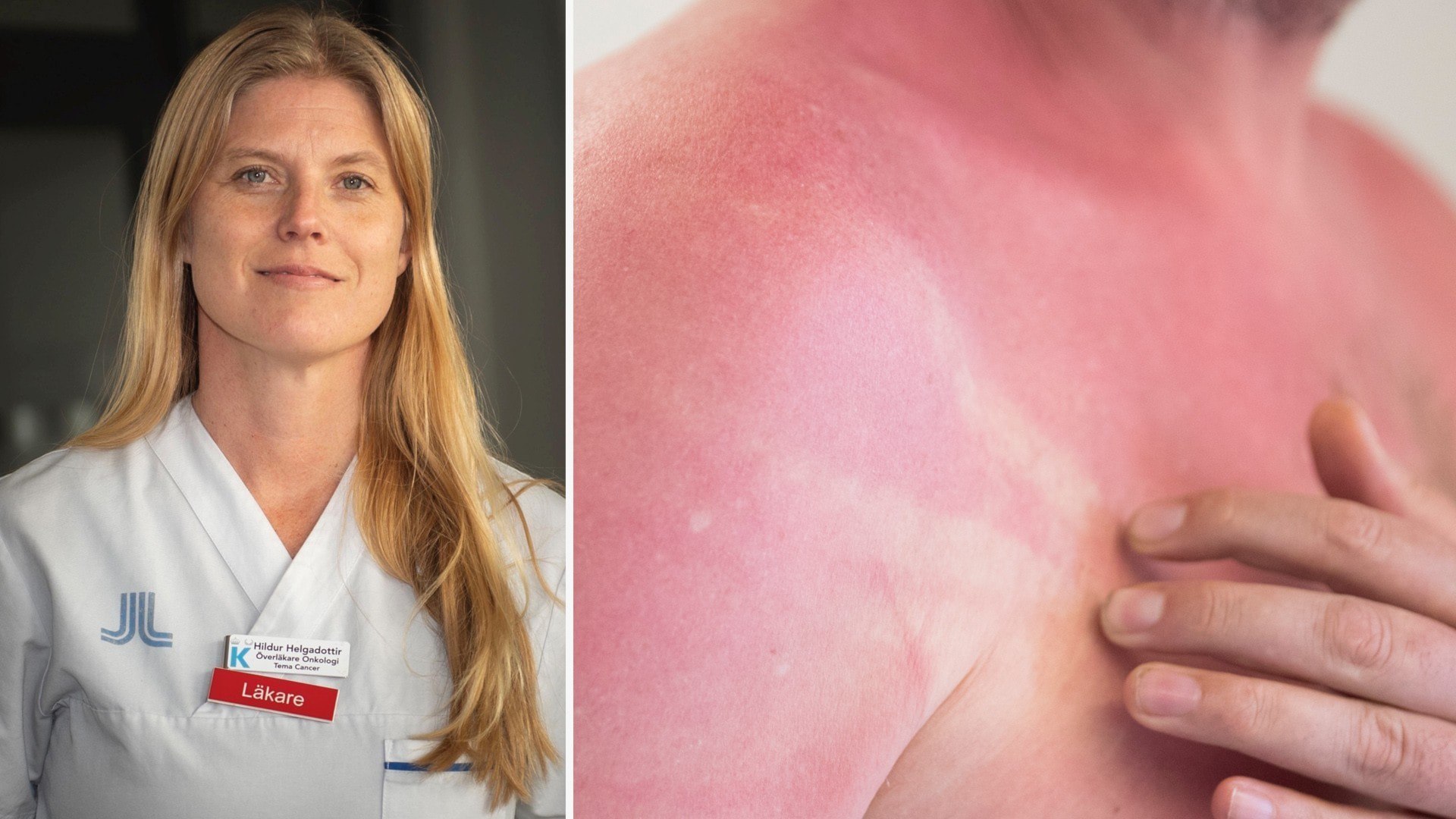 ⚡️ تغییر روند: تعداد کمتری از بزرگسالان زیر ۵۰ سال به سرطان پوست مبتلا می‌شوند