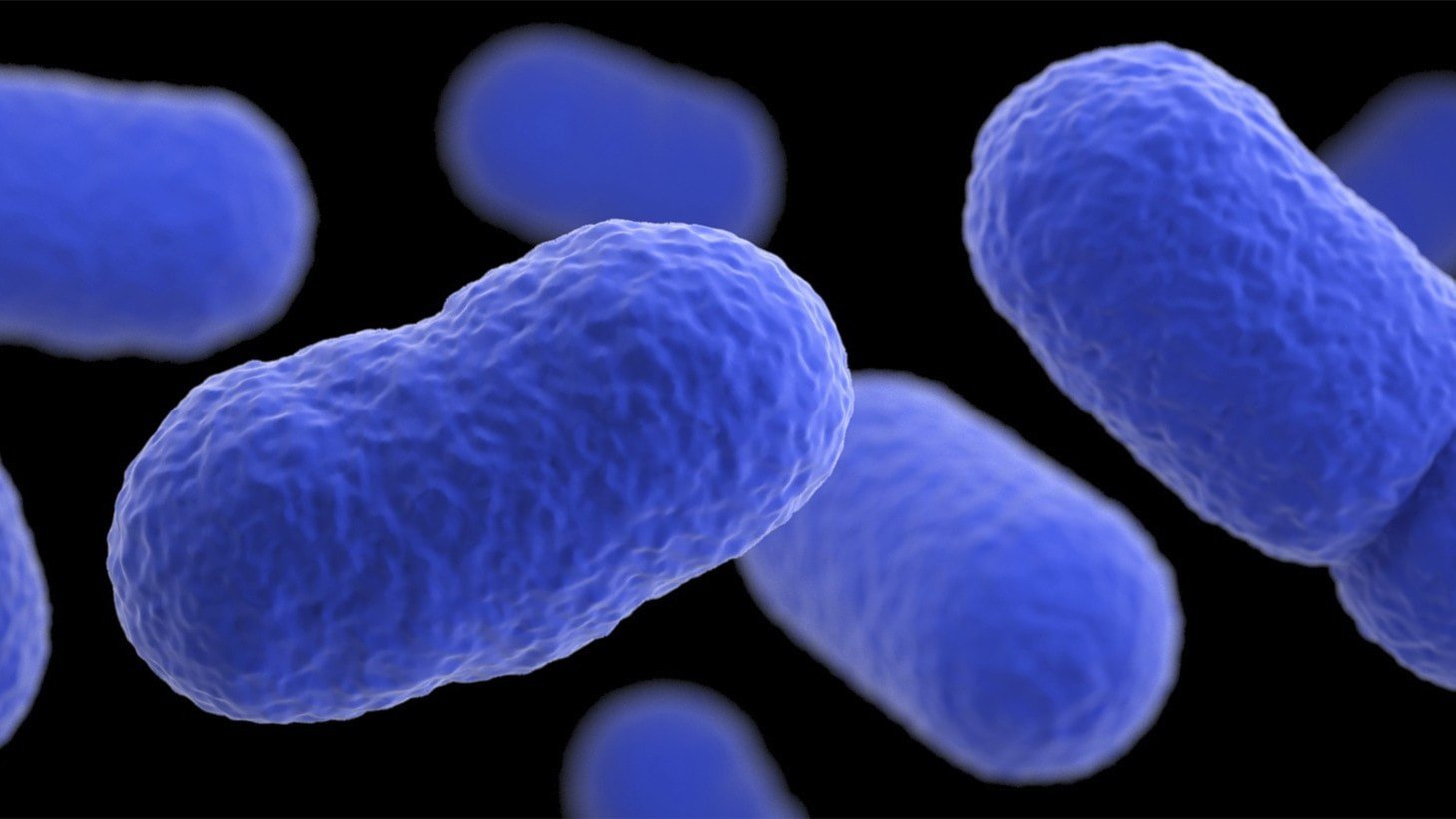 ⚡️ هماهنگکننده کنترل بهداشت توضیح میدهد: این لیستریا است