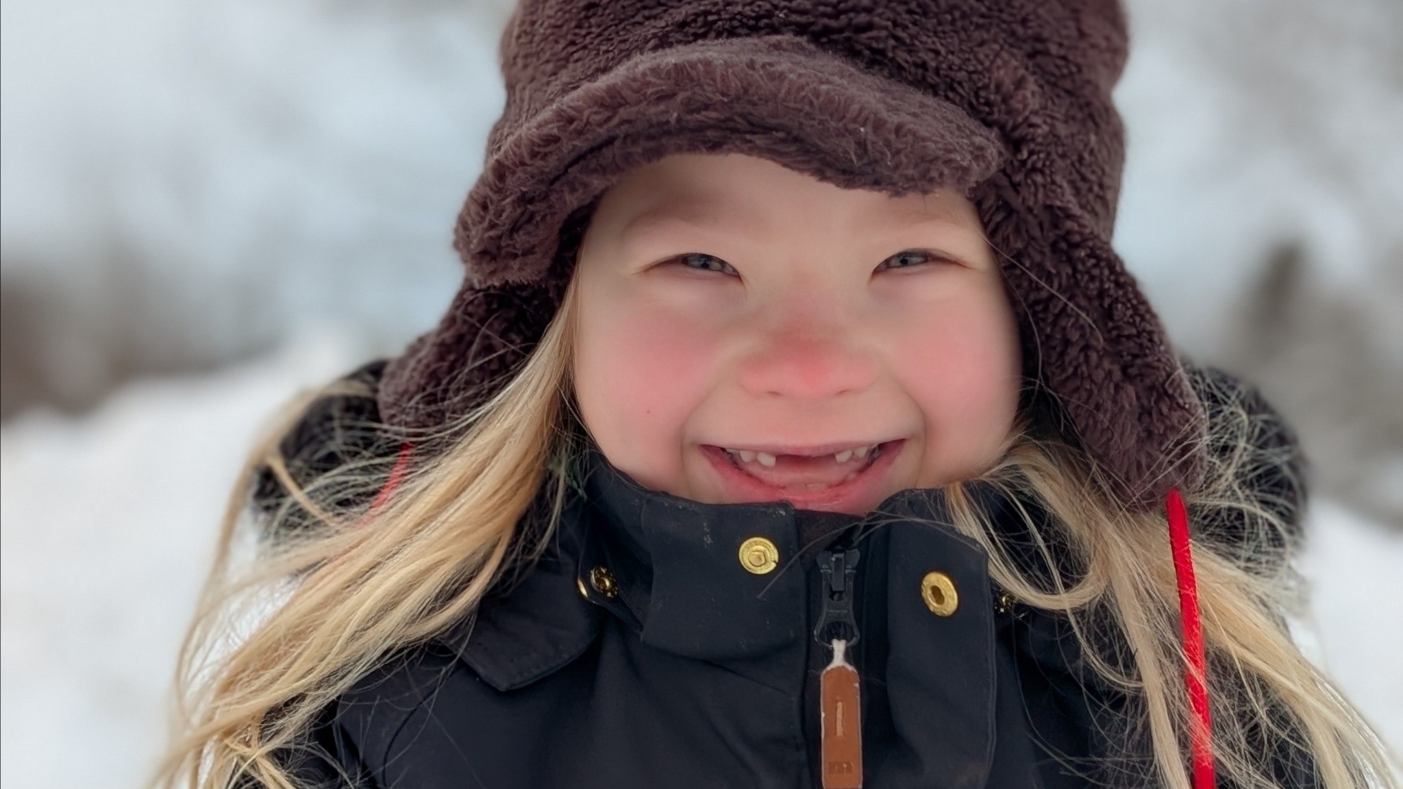 ⚡️ کمبود شدید متخصص آلرژی؛ با این وجود لوی ۶ ساله، کمک گرفت